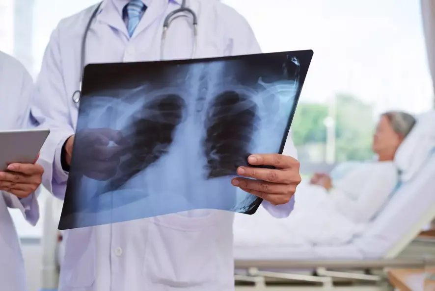 Pneumonie Röntgenbild Lunge